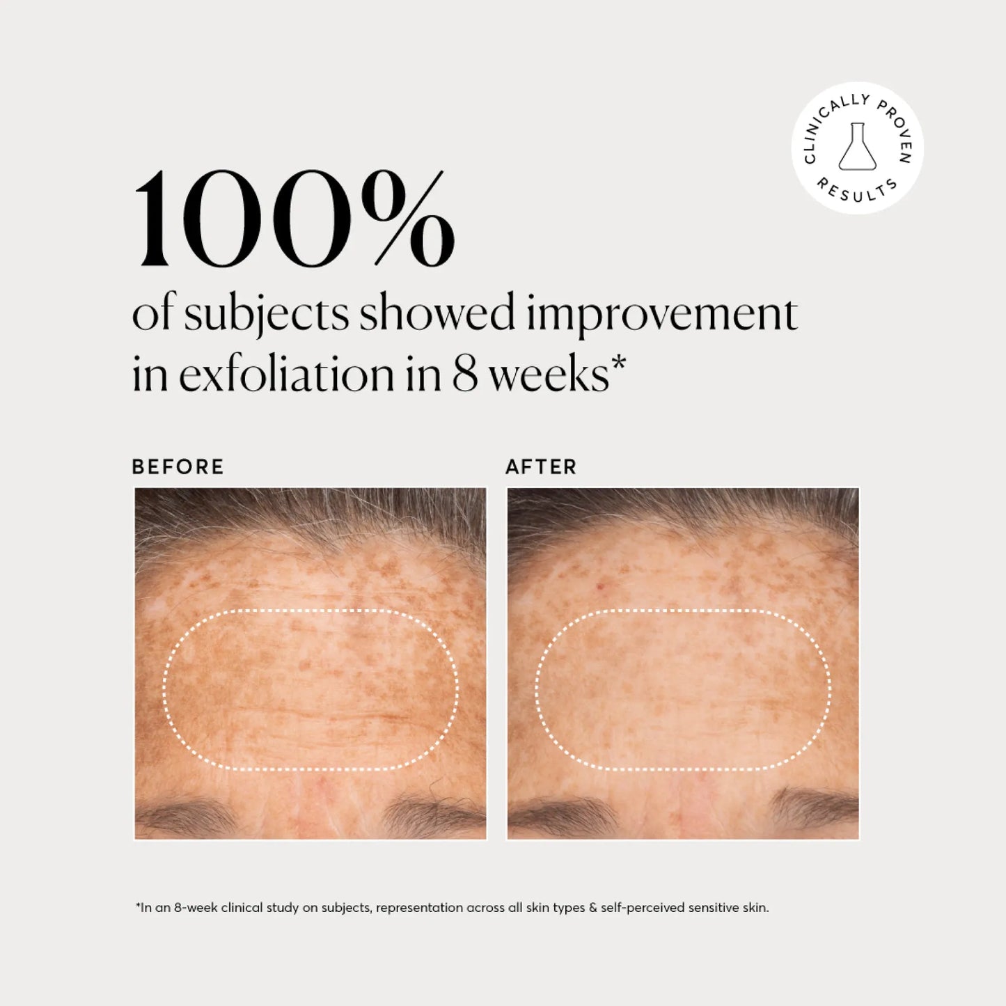 bha-liquid-exfoliant-2-t5 NATR-10027-Alt-Images-BHA-Liquid-Exfoliant-2_-03.webp